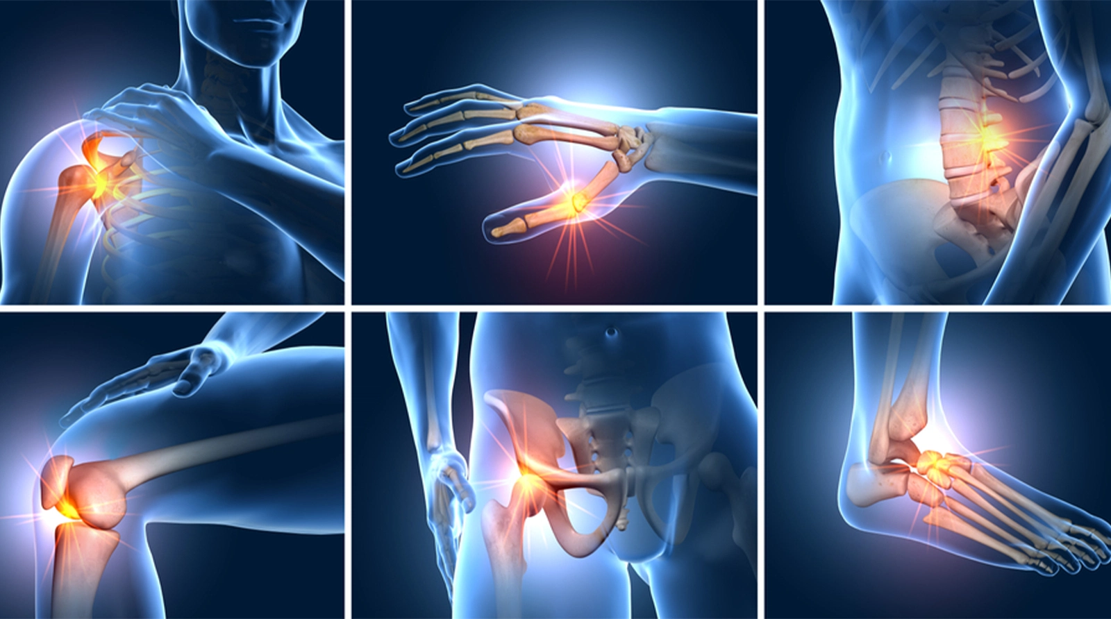 Bone and Joint Care
